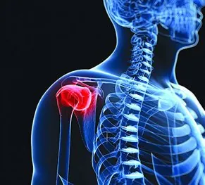 Bone & Soft Tissue Tumor