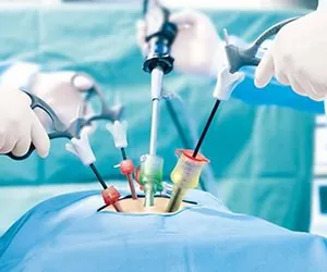 Why is Laparoscopic Surgery Done
